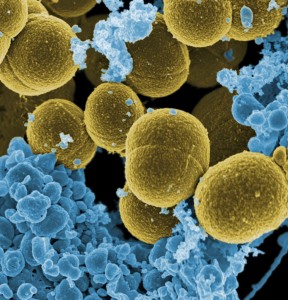 Staphylococcus aureus Bacteria